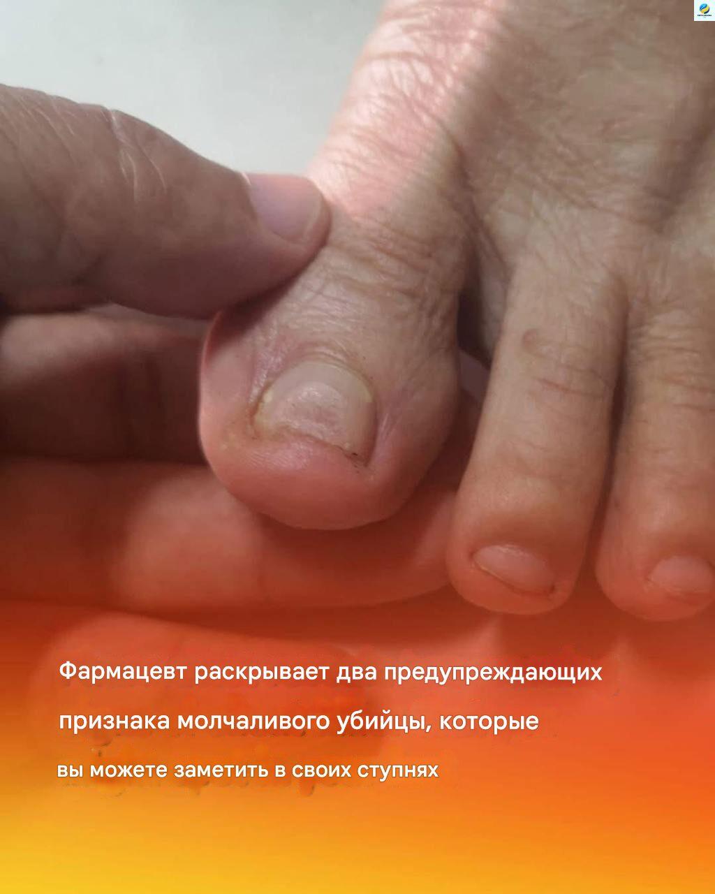 Ноги та захворювання серця