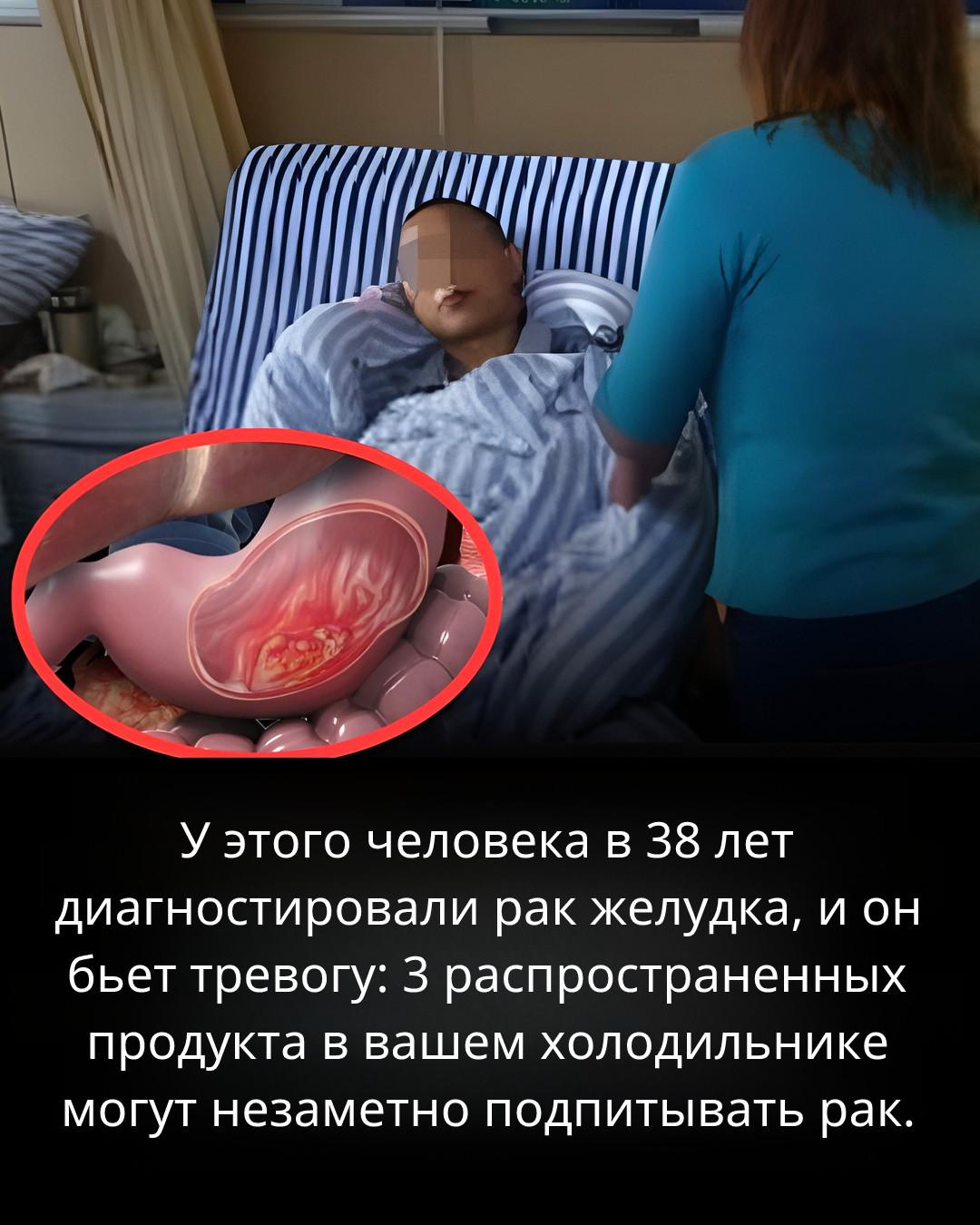 為什麼早期檢測到結腸癌如此重要