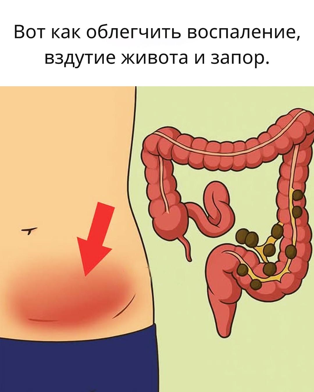 炎症，腹脹，便秘：為什麼這些問題如此頻繁？