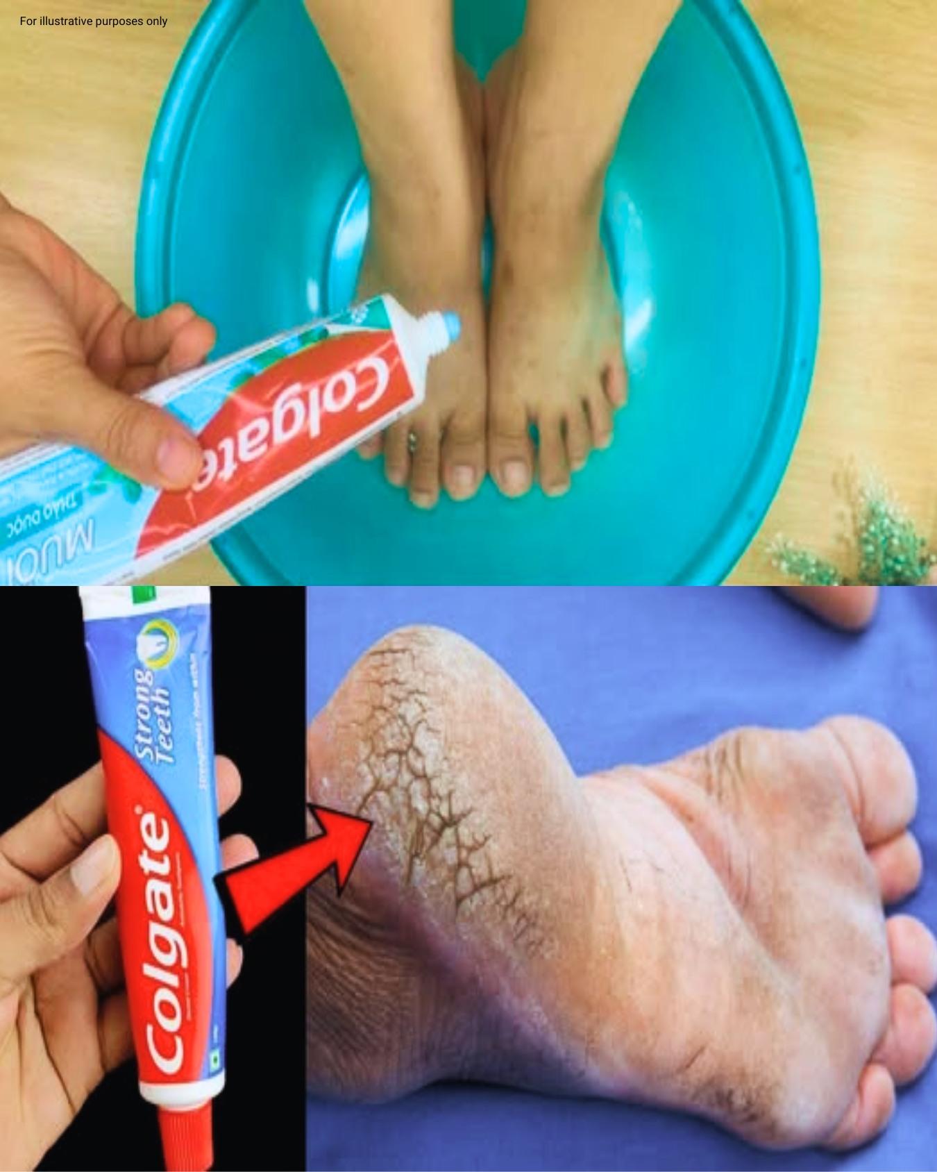 是什麼導致腳跟上的裂縫？