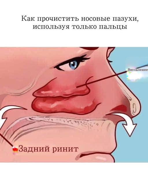 鼻竇 – 一個常見的問題