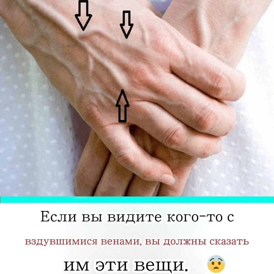 1。藍靜脈的原因是什麼？